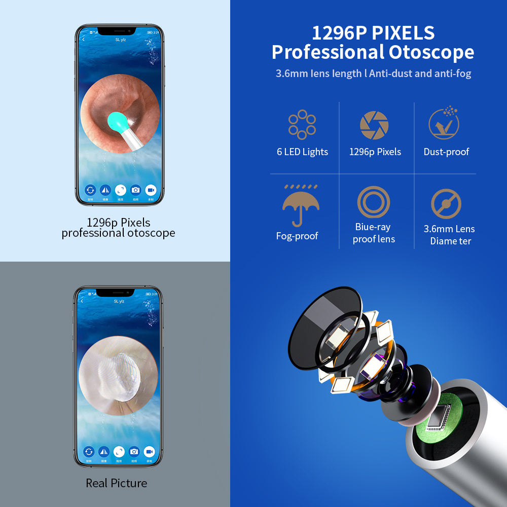 NE3 Smart Ear Cleaner Wireless camera